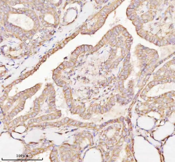 Anti-MICALL1 Antibody