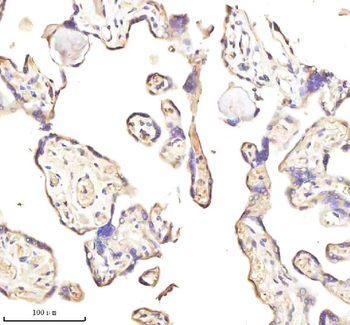 Anti-MEST Antibody