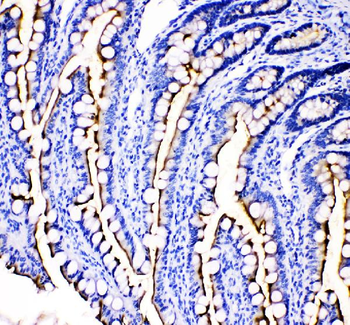 Anti-MEP1B Antibody
