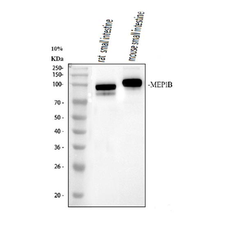 Anti-MEP1B Antibody