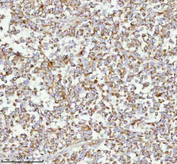 Anti-MELTF Antibody