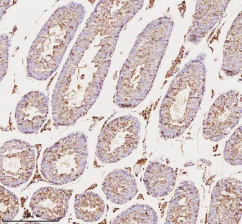 Anti-MELTF Antibody