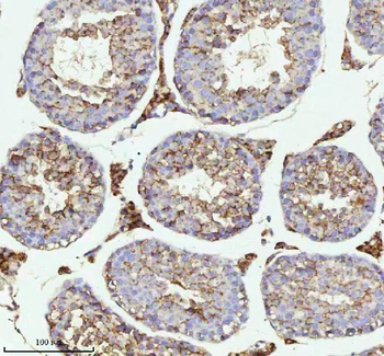 Anti-MELTF Antibody