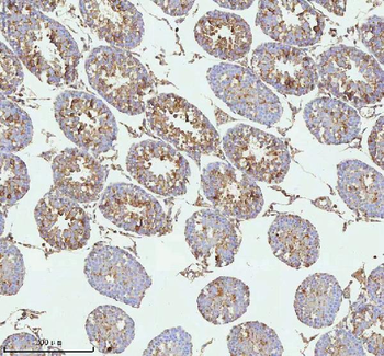 Anti-MELTF Antibody
