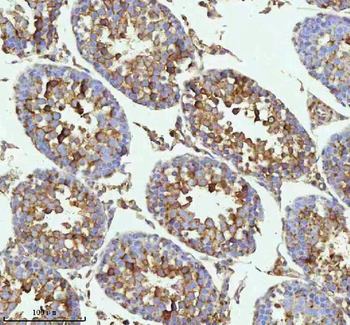 Anti-MELTF Antibody