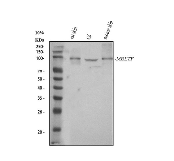 Anti-MELTF Antibody