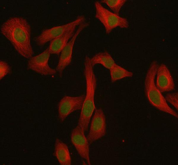 Anti-MED4 Antibody