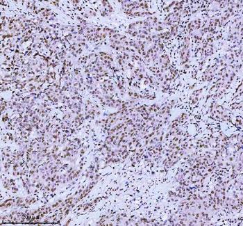 Anti-MED4 Antibody