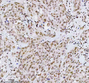 Anti-MED4 Antibody