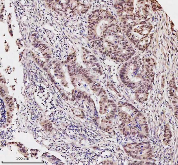 Anti-MED4 Antibody