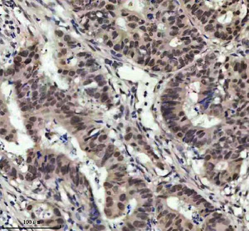 Anti-MED4 Antibody