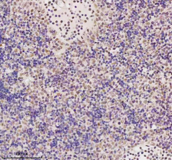Anti-MED4 Antibody