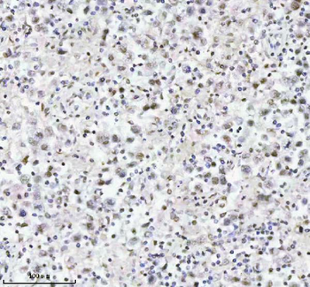 Anti-MED4 Antibody