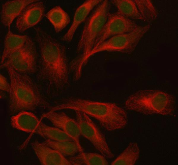 Anti-PTRHD1 Antibody