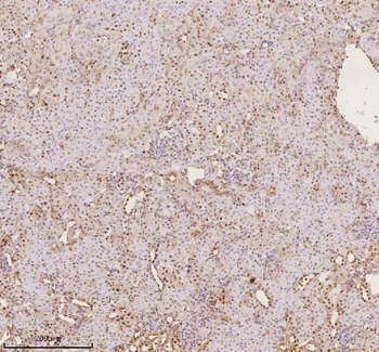 Anti-PTRHD1 Antibody