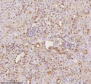 Anti-PTRHD1 Antibody