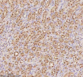 Anti-PTRHD1 Antibody