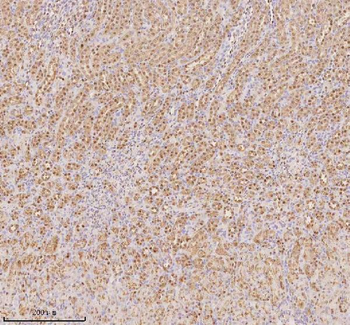 Anti-PTRHD1 Antibody
