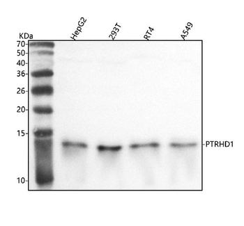 Anti-PTRHD1 Antibody