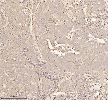 Anti-PTCD1 Antibody