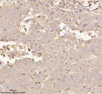 Anti-PTCD1 Antibody