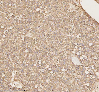 Anti-PTCD1 Antibody