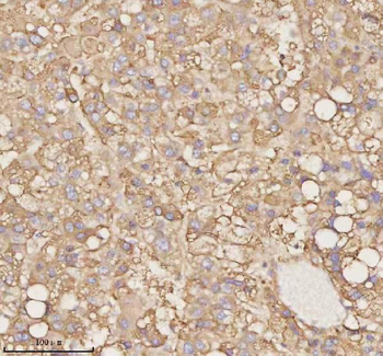 Anti-PTCD1 Antibody