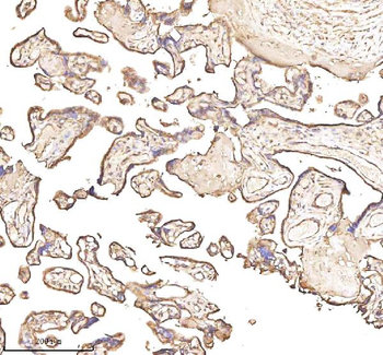 Anti-PTCD1 Antibody