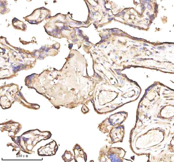 Anti-PTCD1 Antibody