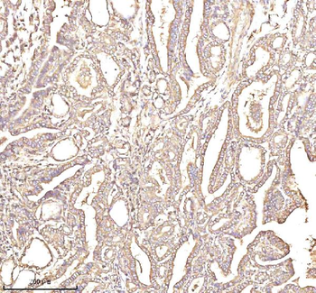 Anti-PTCD1 Antibody