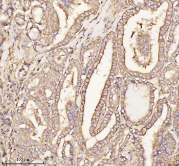 Anti-PTCD1 Antibody