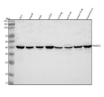 Anti-PSMD13 Antibody