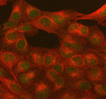 PARP1 Antibody