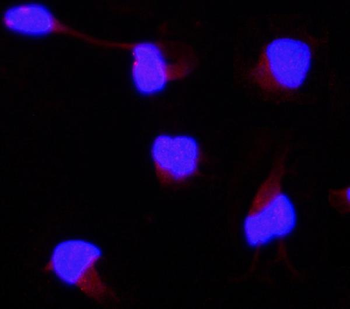 Anti-AAMP CCL18 Antibody