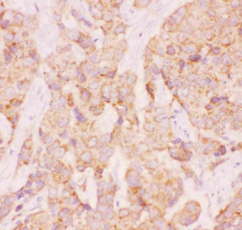 Anti-AAMP CCL18 Antibody