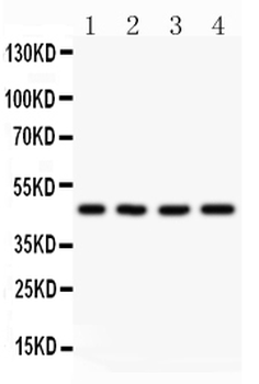 Anti-AAMP CCL18 Antibody