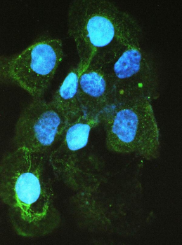 Anti-Angiotensin Converting Enzyme 1/ACE Antibody