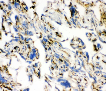 Anti-Angiotensin Converting Enzyme 1/ACE Antibody