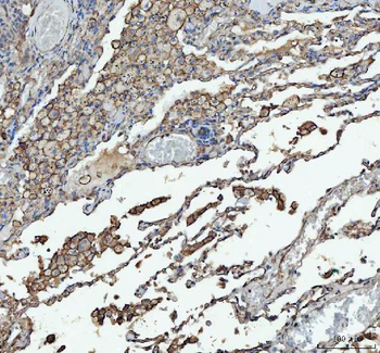 Anti-Angiotensin Converting Enzyme 1/ACE Antibody