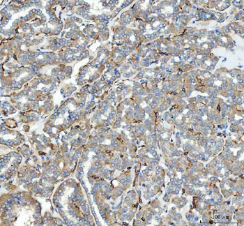 Anti-Angiotensin Converting Enzyme 1/ACE Antibody