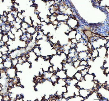 Anti-Angiotensin Converting Enzyme 1/ACE Antibody