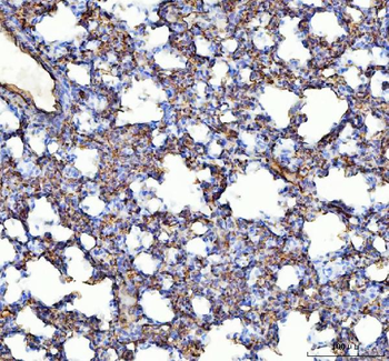 Anti-Angiotensin Converting Enzyme 1/ACE Antibody