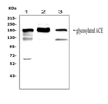 Anti-Angiotensin Converting Enzyme 1/ACE Antibody