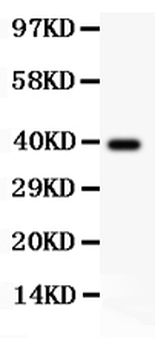 Angiopoietin 1/ANGPT1 Rabbit Polyclonal Antibody