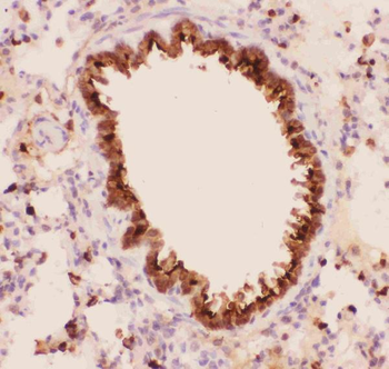 Anti-Annexin A1/ANXA1 Antibody