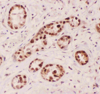 Anti-APE1/APEX1 Antibody