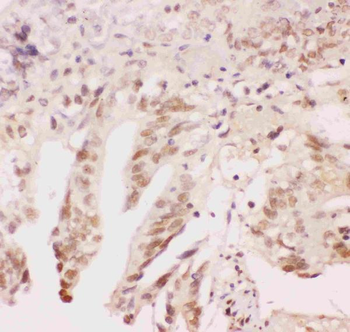 Anti-ATF1 Antibody