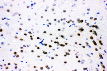 Anti-ATF2 Antibody