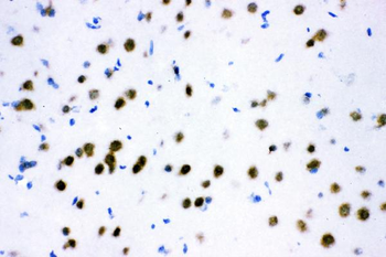 Anti-ATF2 Antibody