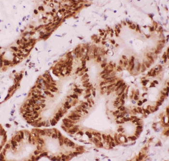 Anti-ATF2 Antibody